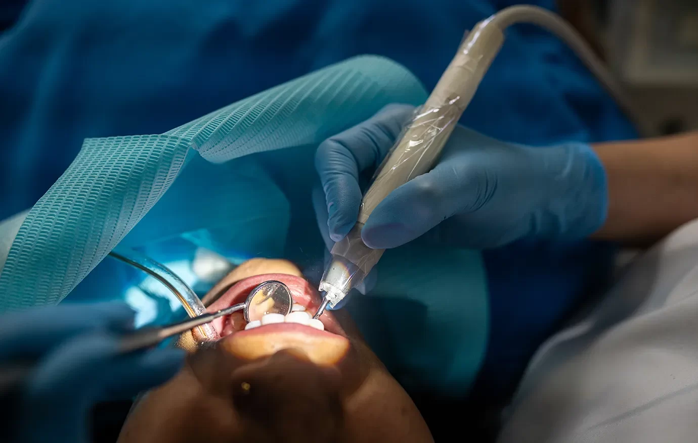Bone Grafting