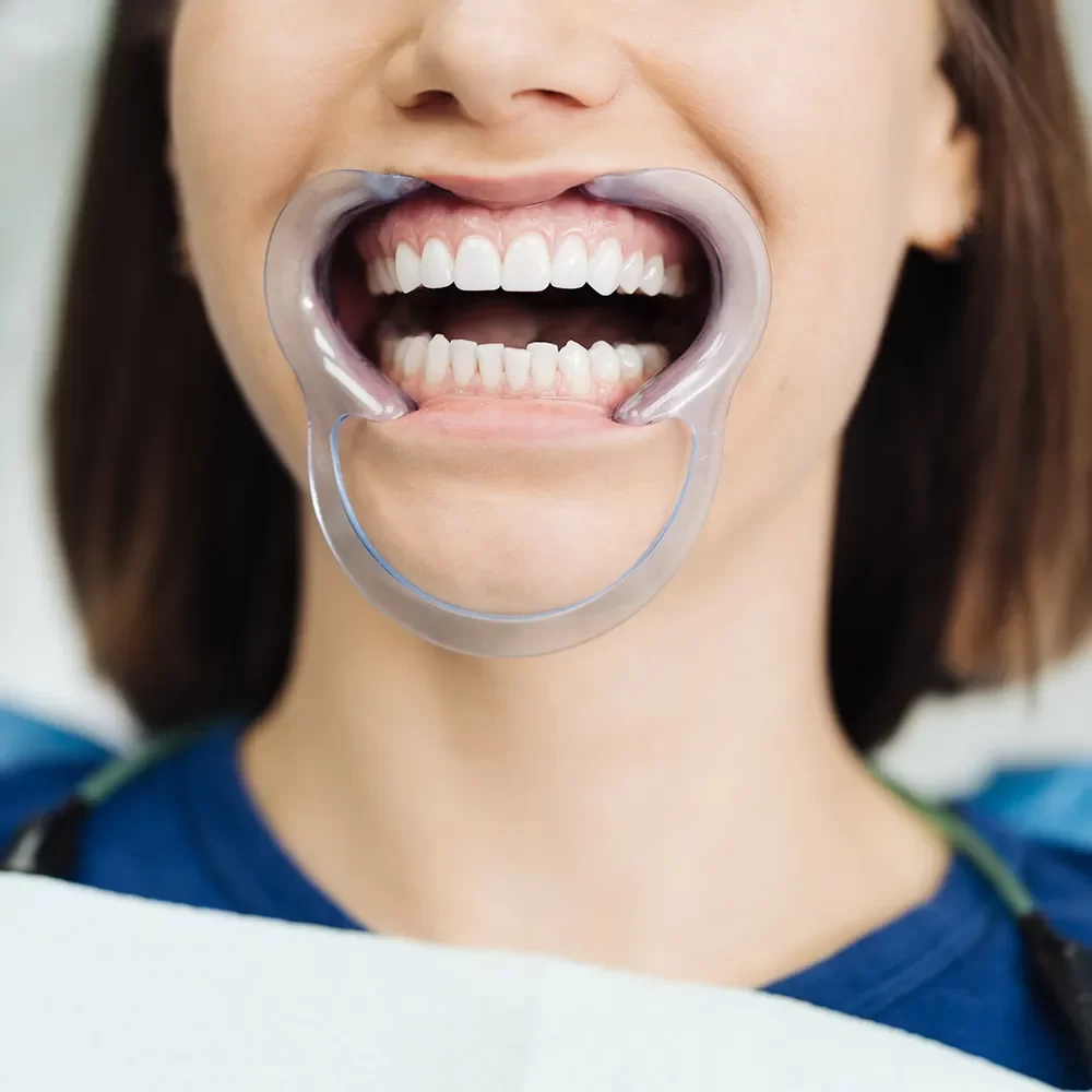 Bone Grafting