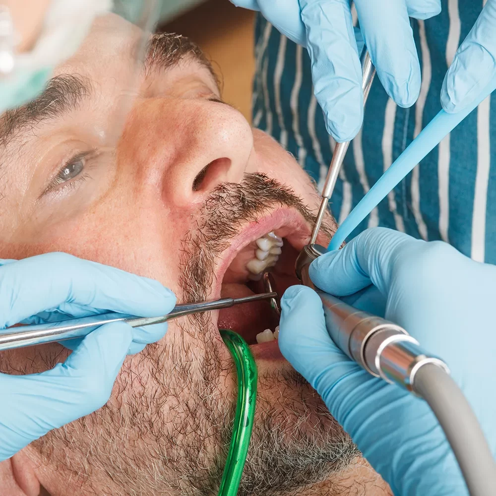Bone Grafting