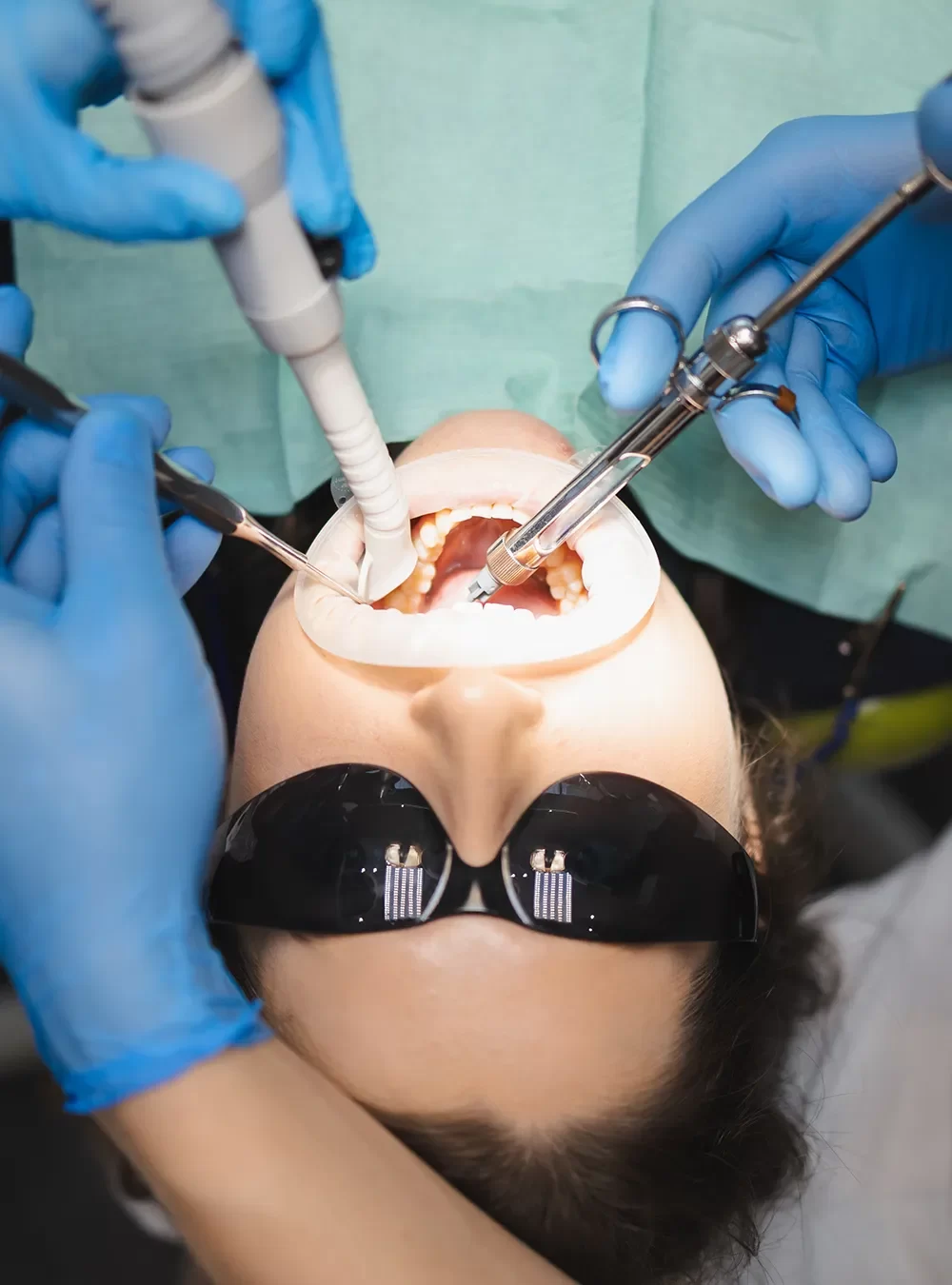 Bone Grafting