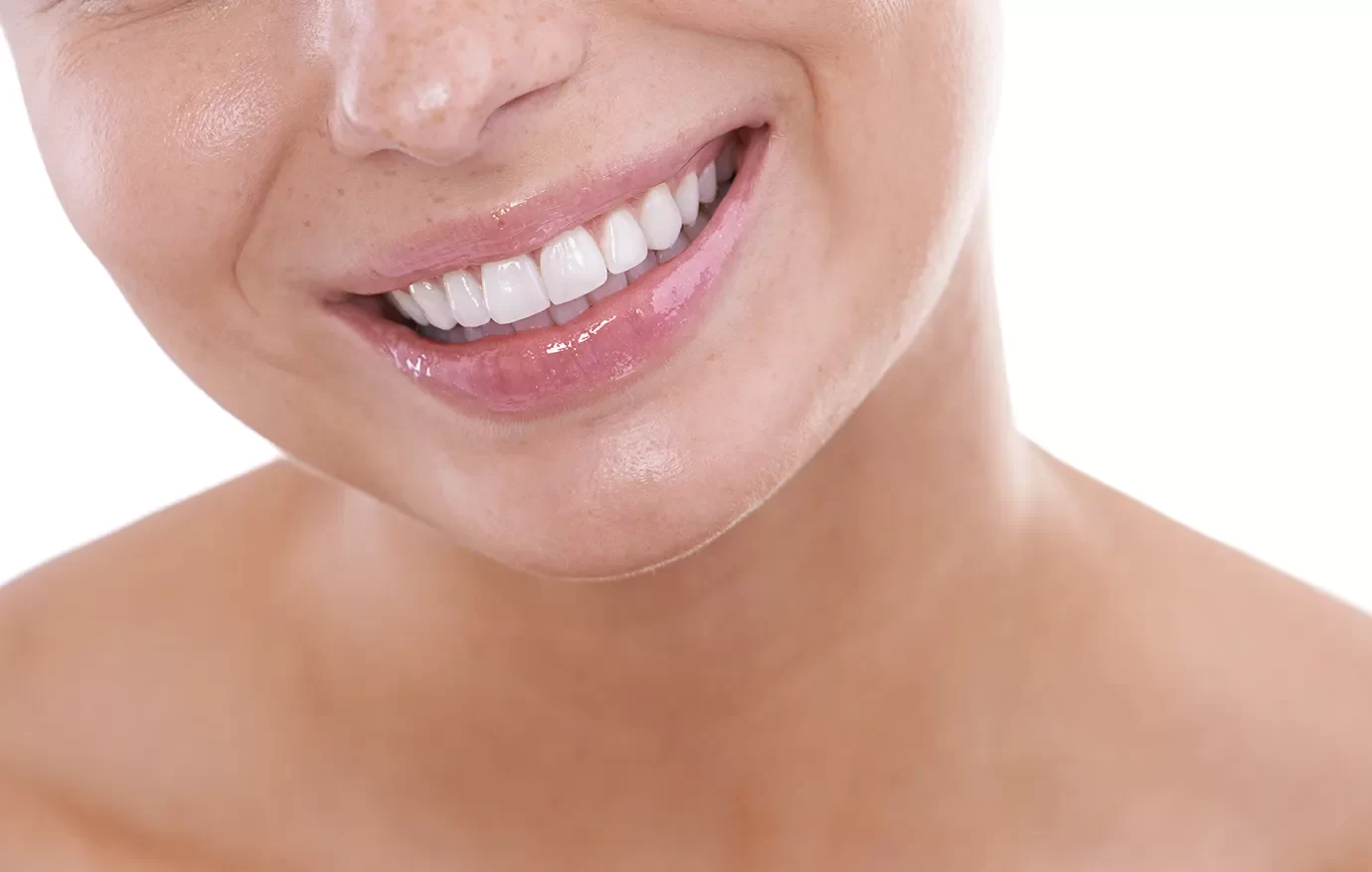 Young woman with freckles smiling confidently with perfect white teeth at Onyx Dentistry clinic in Vaughan, Ontario