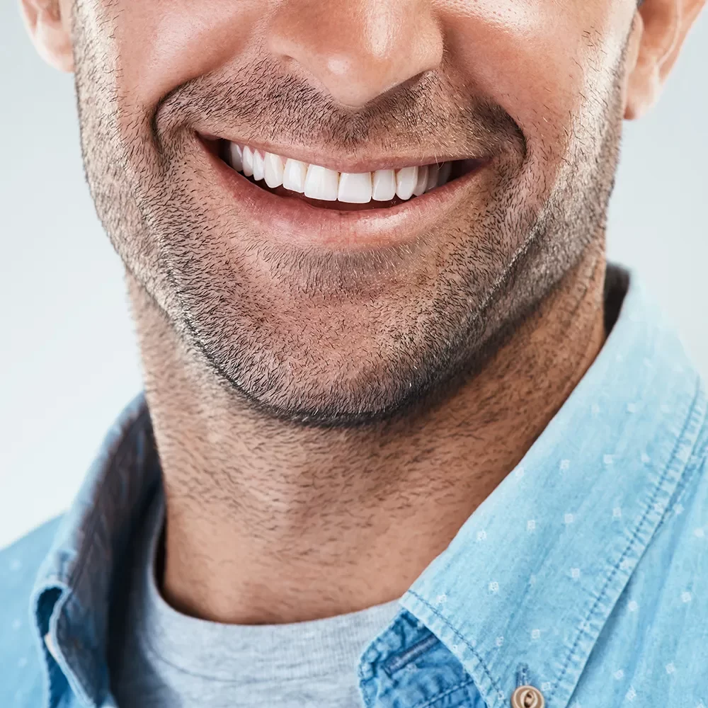 Creating Beautiful, Confident Smiles in Vaughan onyx dentistry