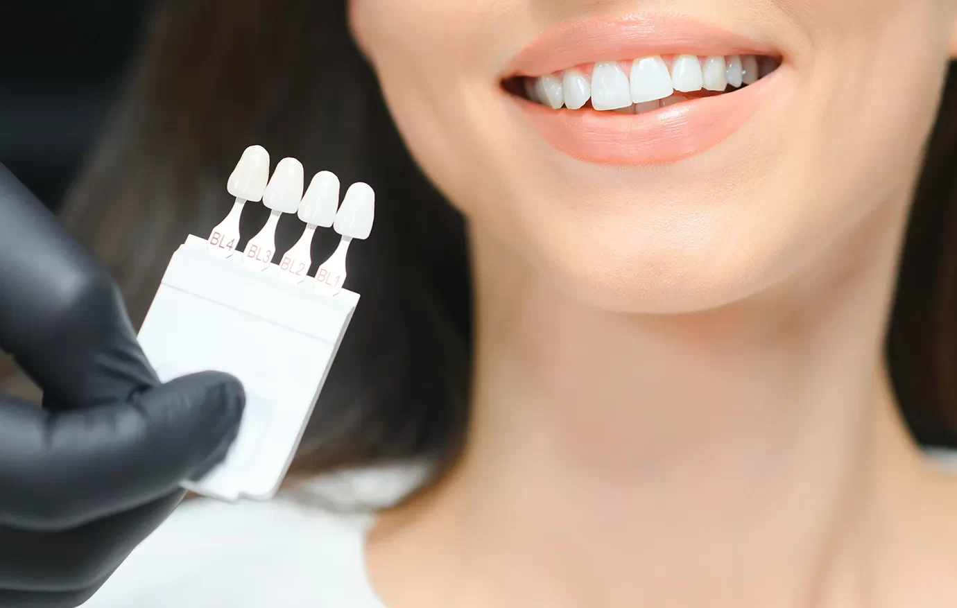 Dental Bridges