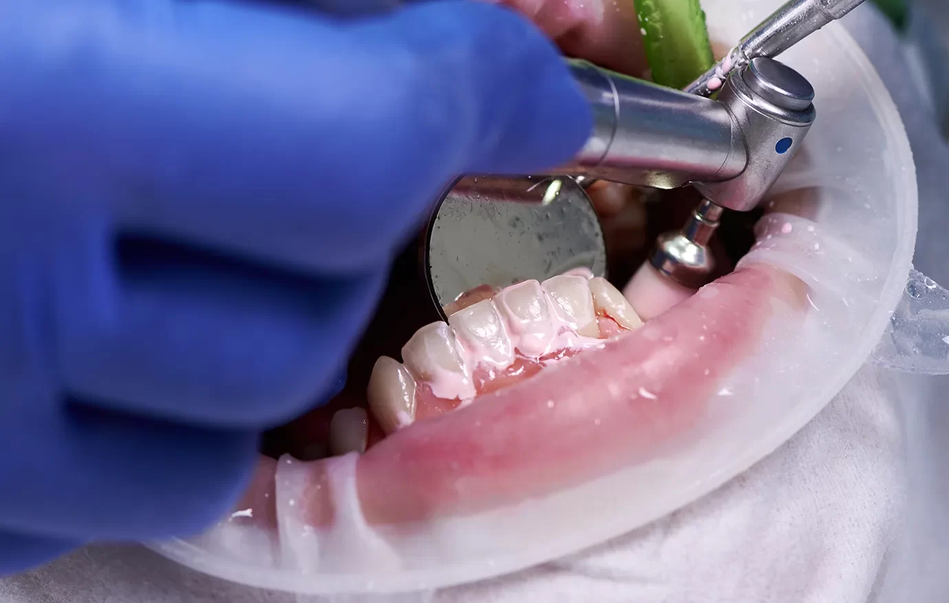 Dental Cleanings