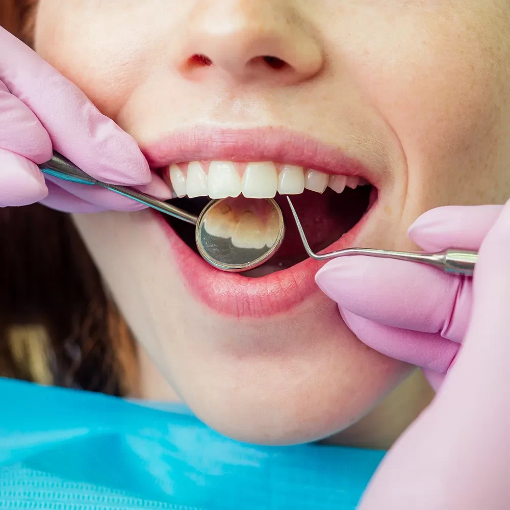 Dental Cleanings