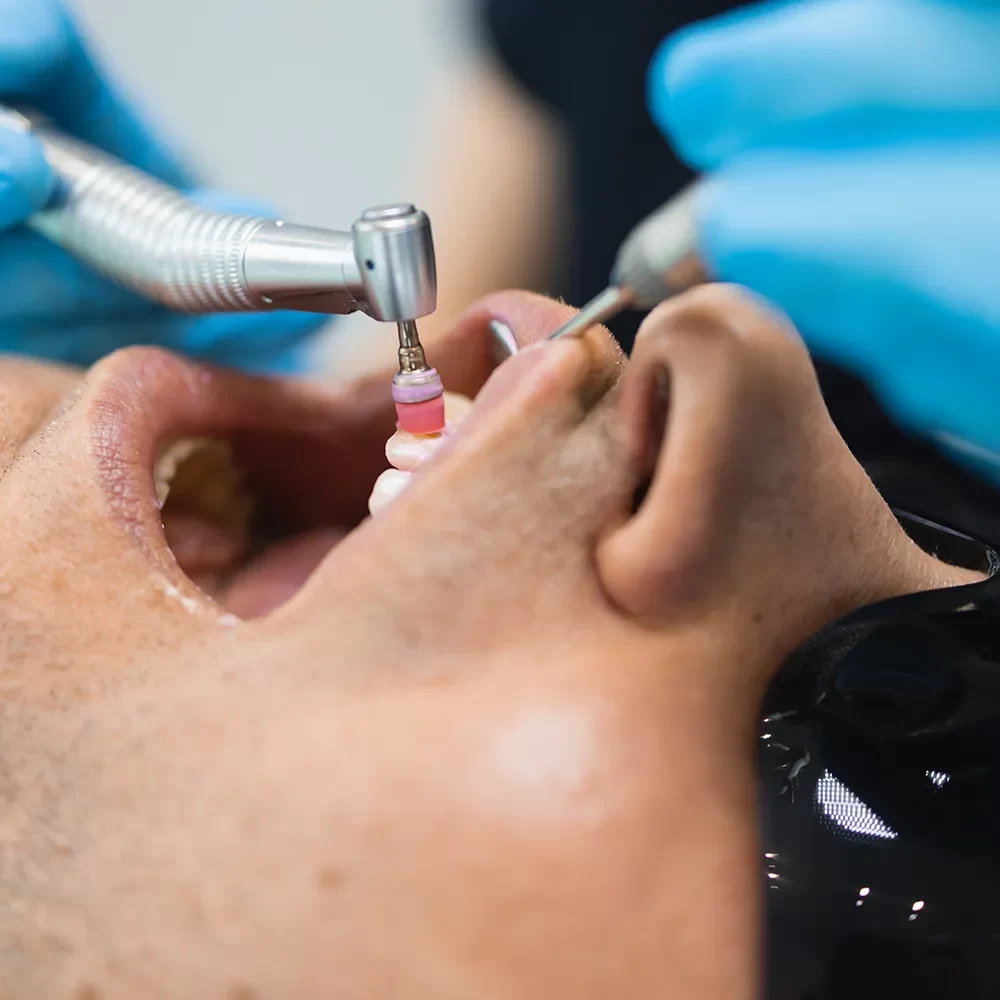 Dental Cleanings