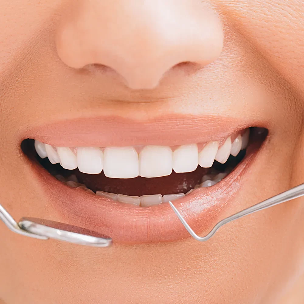 Dental Cleanings