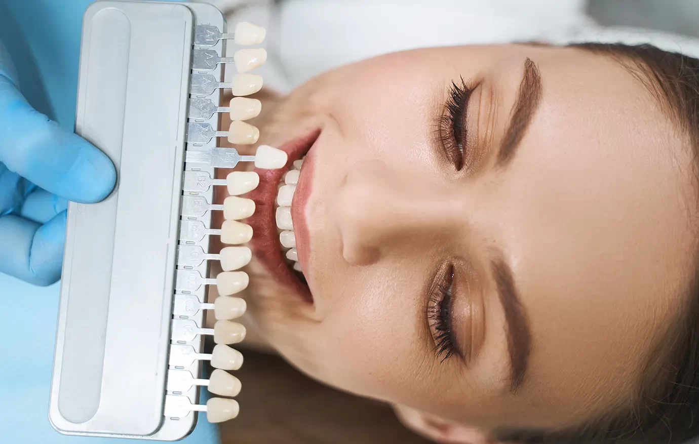 Dental Crowns