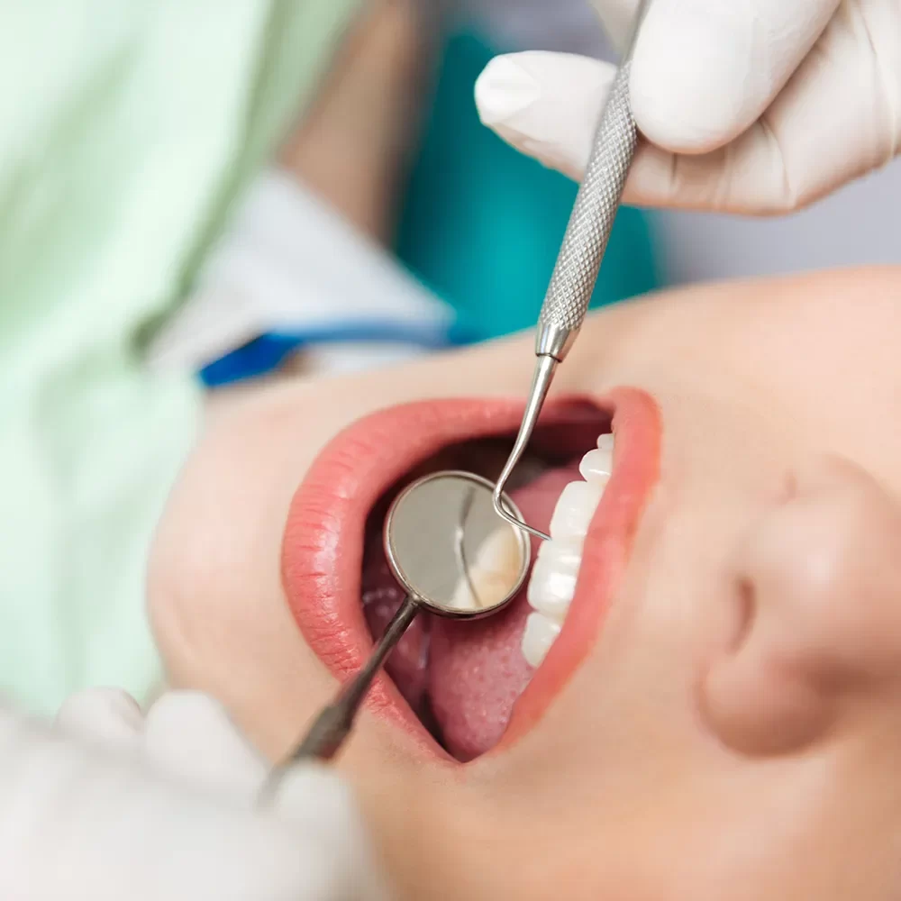 Dental Exams