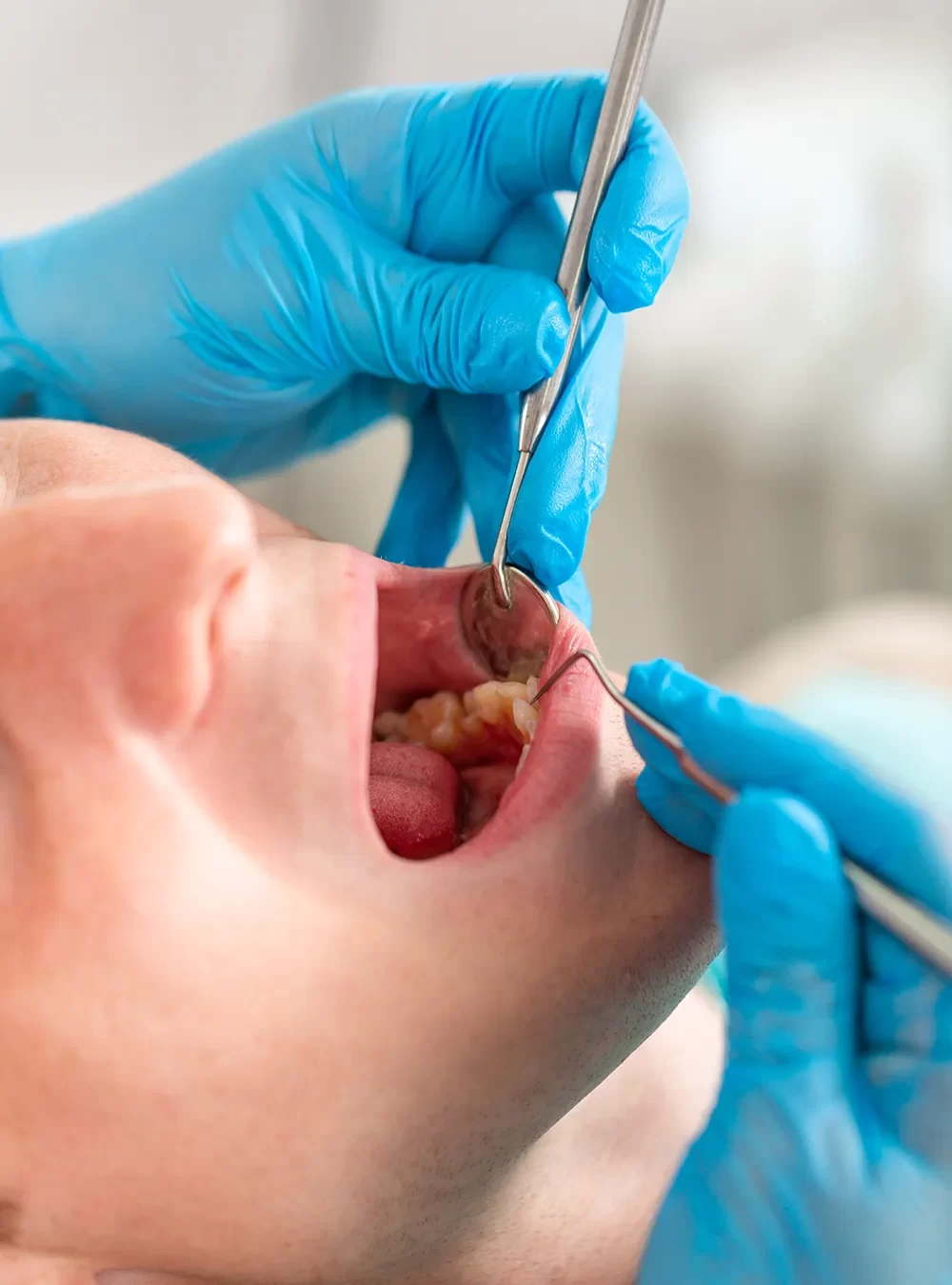 Dental Exams