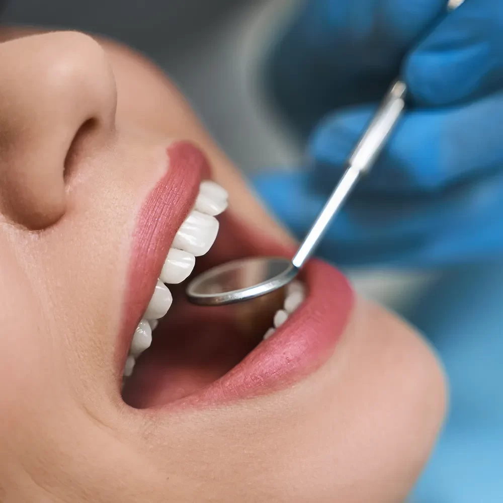 Dental Exams