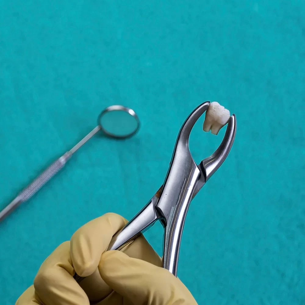 Dental Extraction
