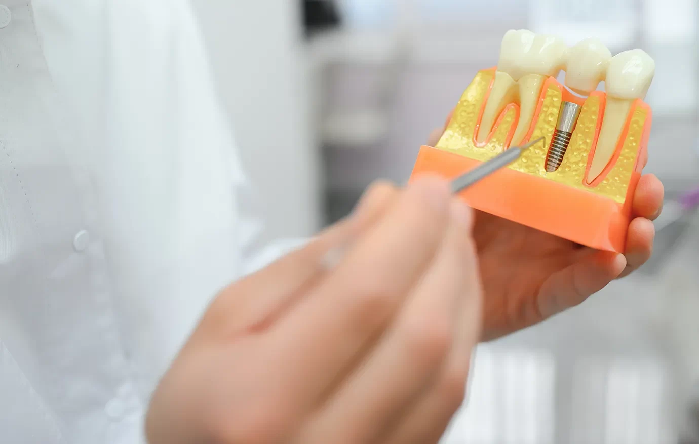 Dental Implants