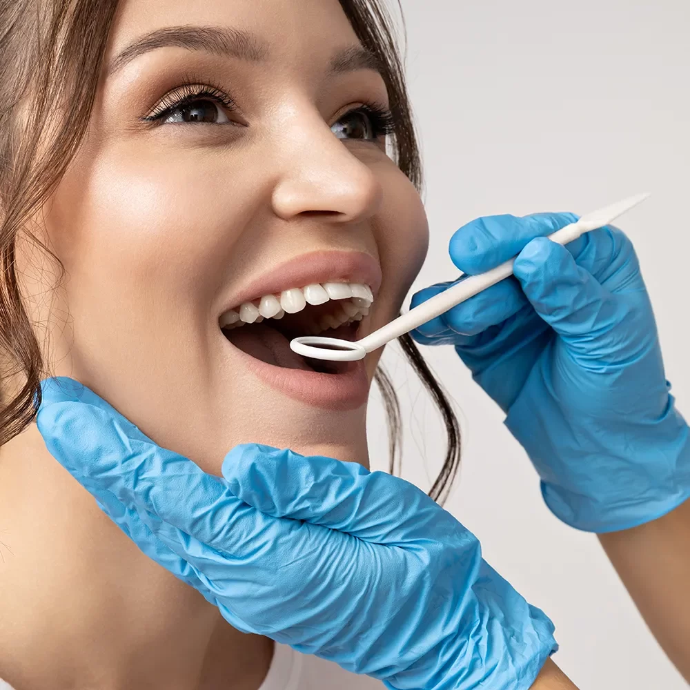 Dental Sealants