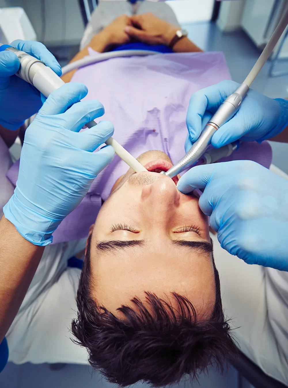 Dental Sealants