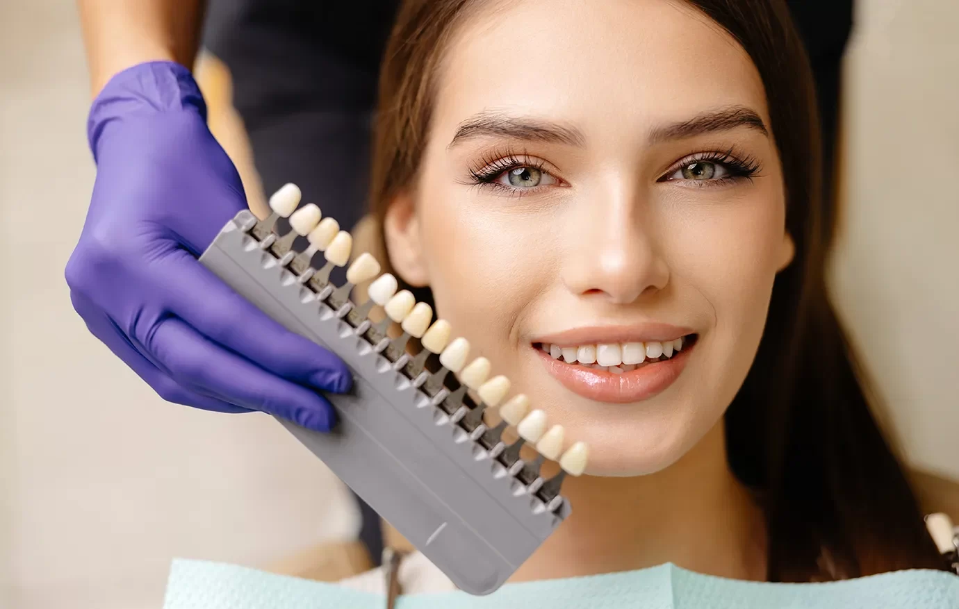 Dental Veneers