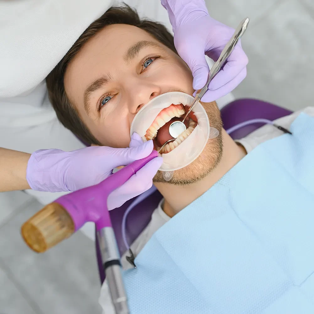Dental Veneers
