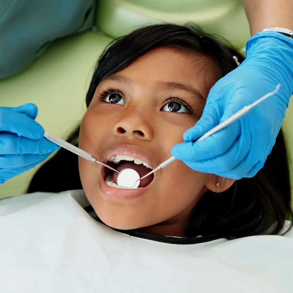 Fluoride Treatments