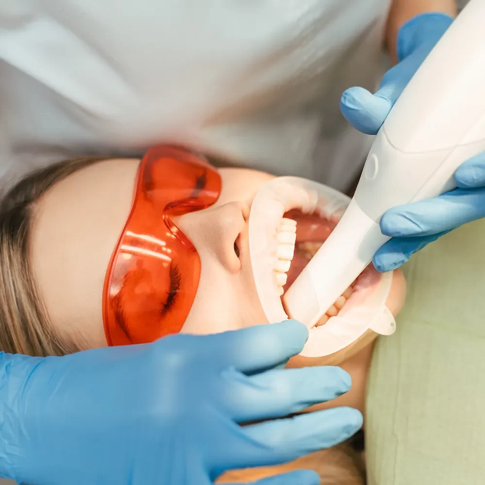 Patient undergoing professional teeth whitening procedure with protective orange glasses and dental mouth retractor, assisted by dentist in blue gloves.