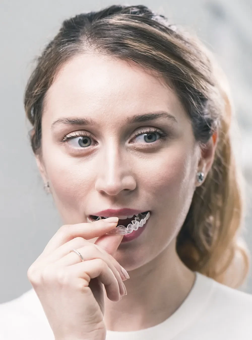 Invisalign & Clear Aligners