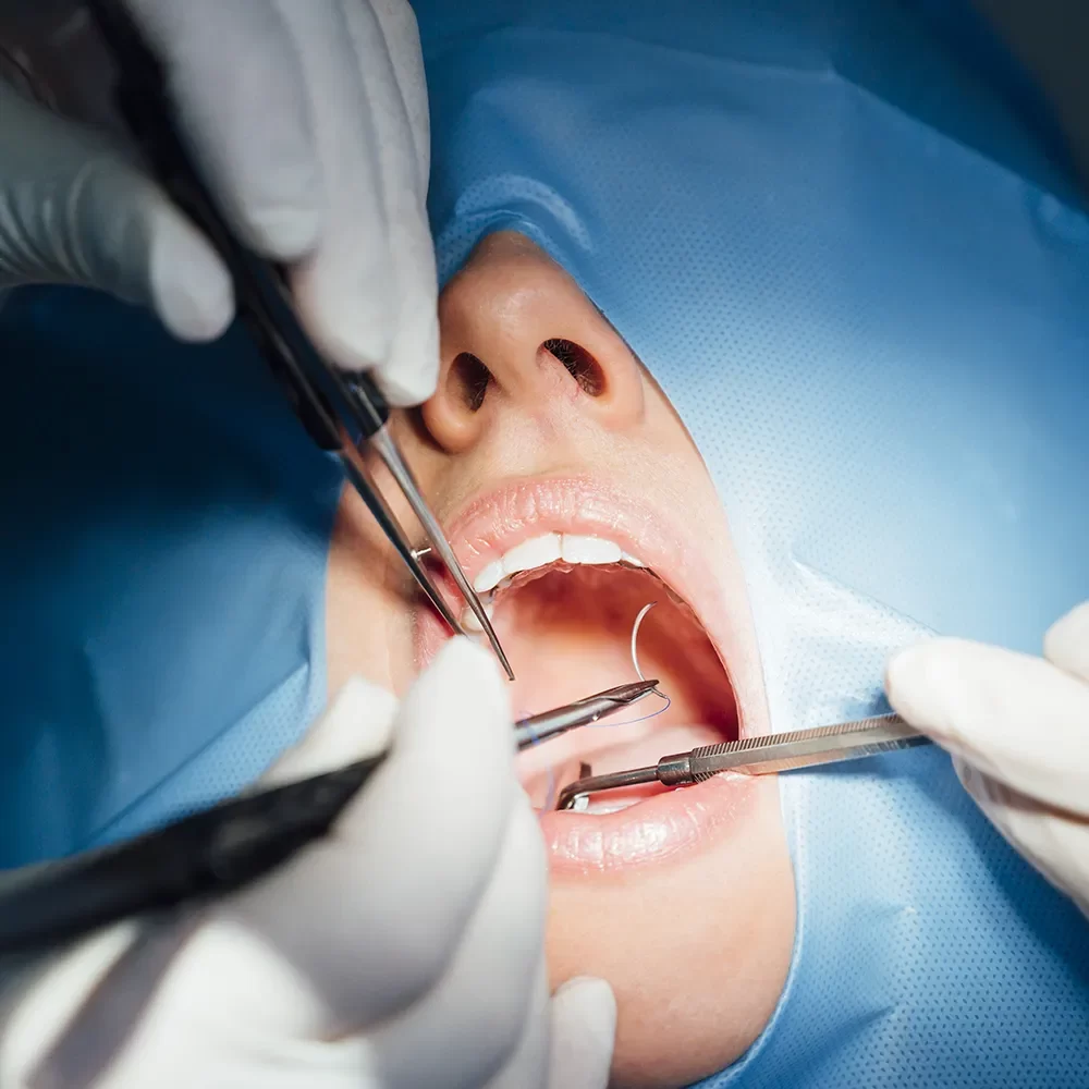 Skilled dental professionals delivering advanced oral surgery care