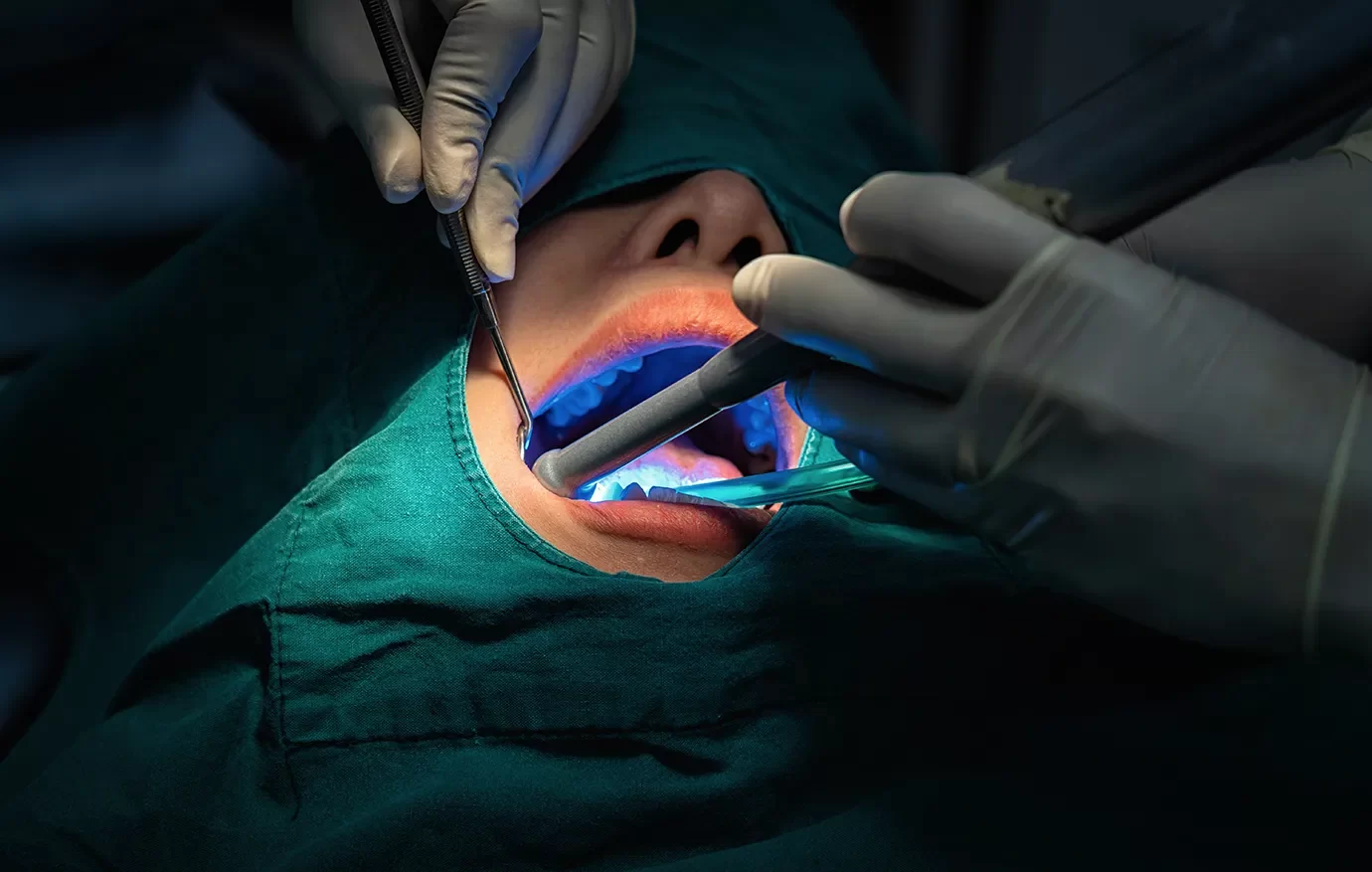 Oral surgeon using advanced tools for safe tooth removal procedure