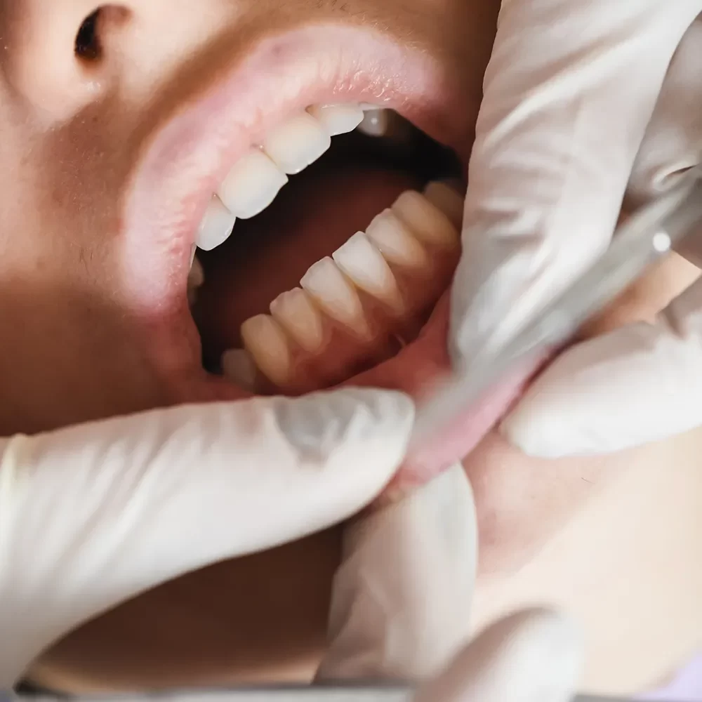 Periodontics