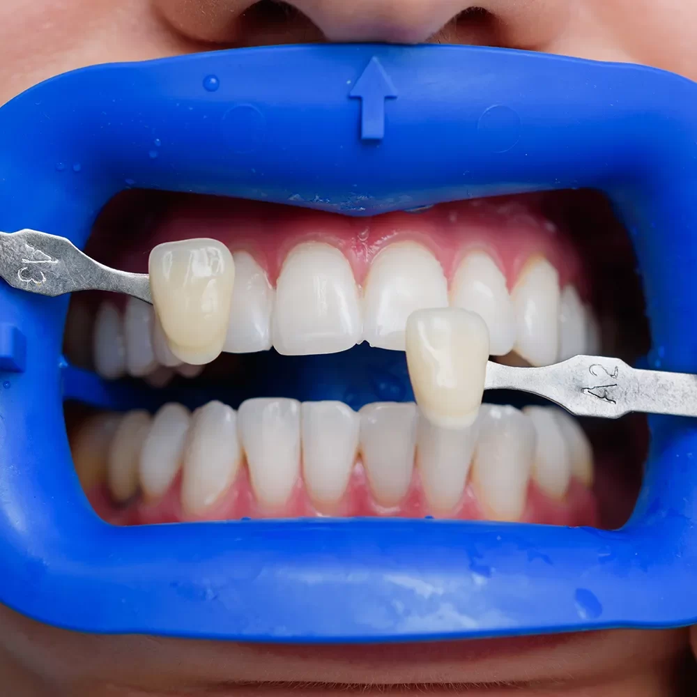 Dental team providing general dentistry services for a healthy, confident smile.
