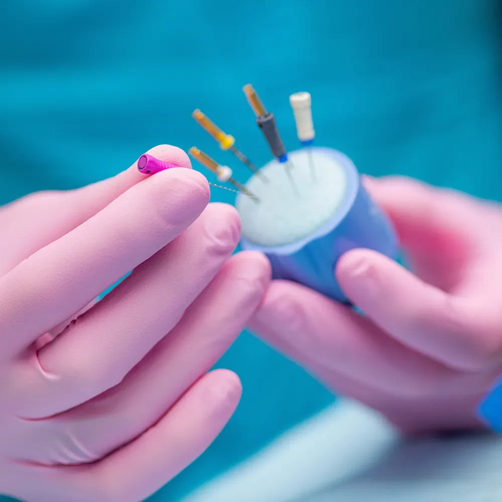 Root Canal Therapy