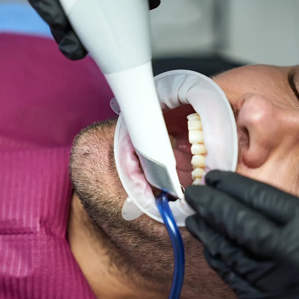 Root Canal Therapy
