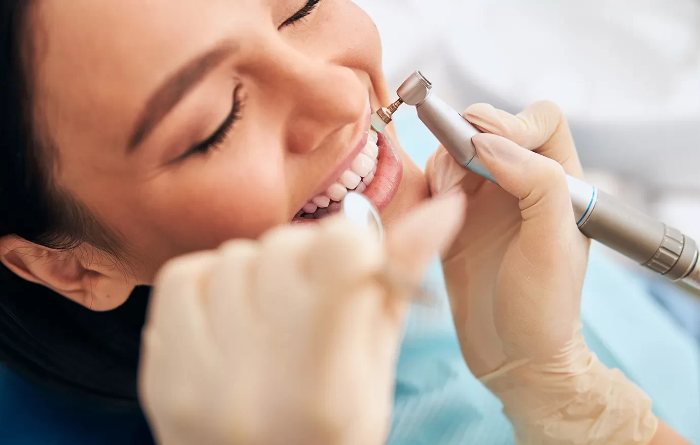 Patient receiving a regular prophylactic dental cleaning at Onyx Dental Clinic in Canada.
