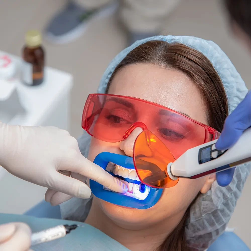 Smile Makeovers