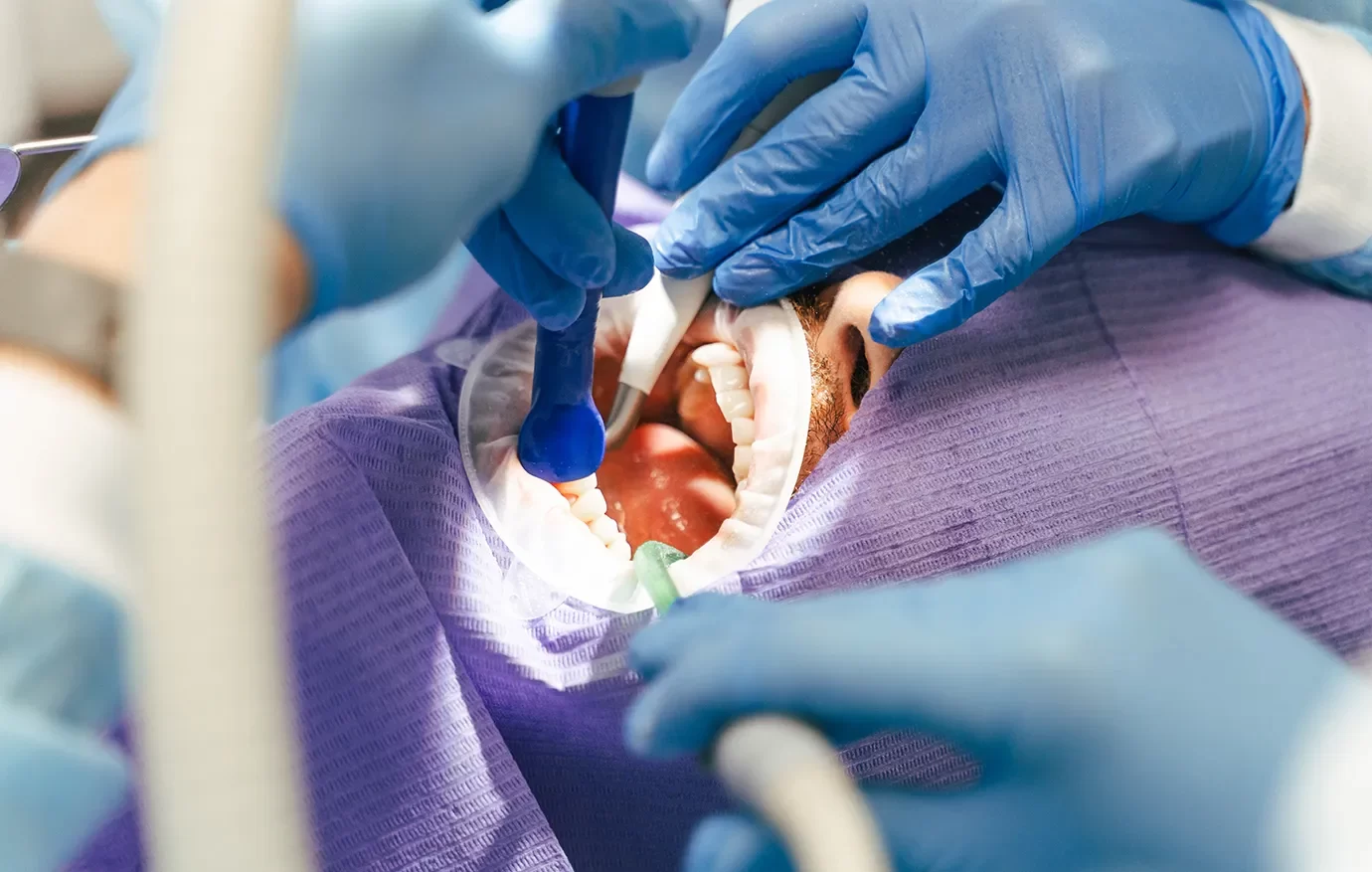 TMJ Treatment - Onyx Dentistry - Dental Clinic