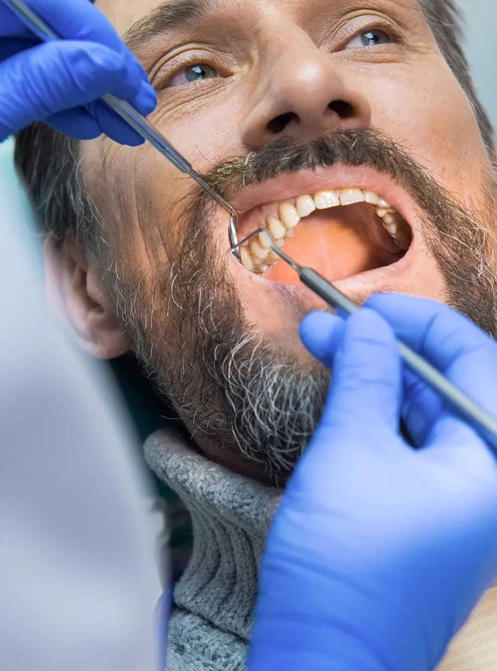 Close-up of a man receiving a thorough dental check-up, with a dentist using precision instruments to ensure optimal oral health at Onyx Dentistry.
