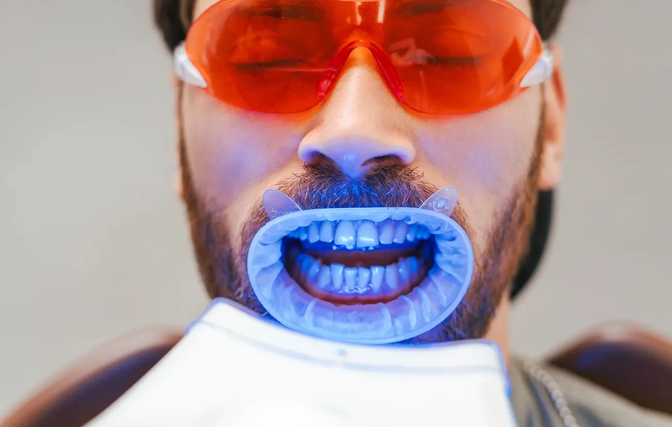 Teeth Whitening