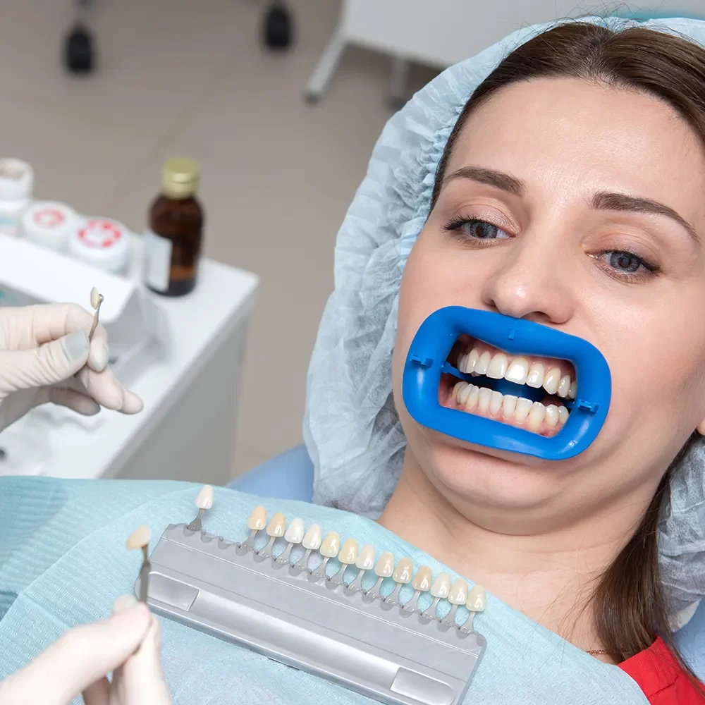 Teeth Whitening