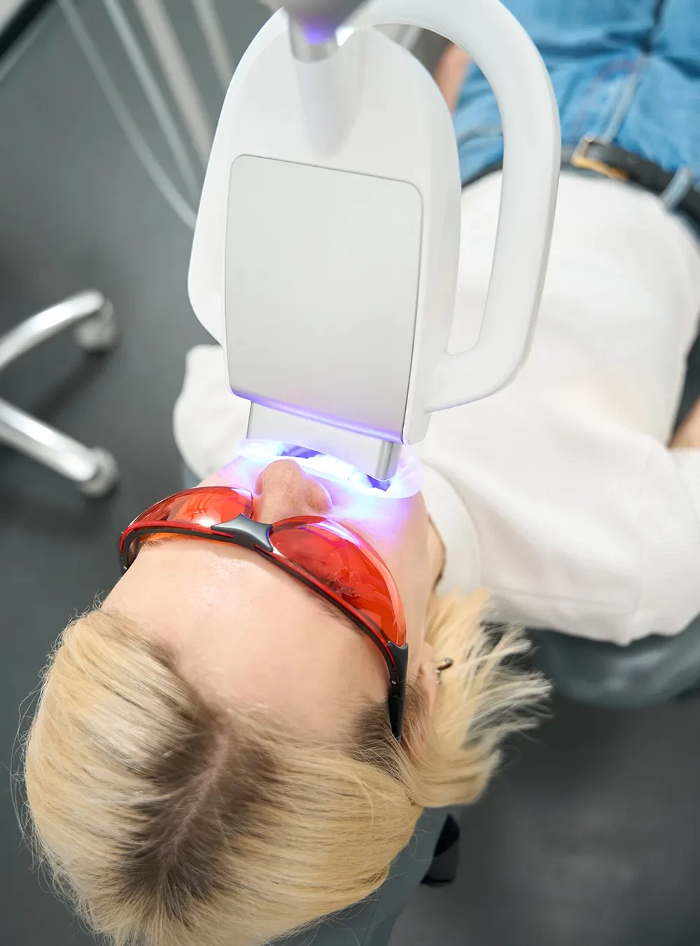 Teeth Whitening