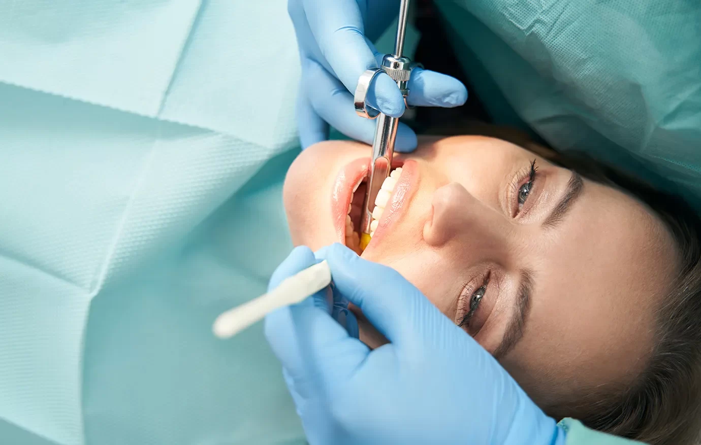 Wisdom Teeth Removal